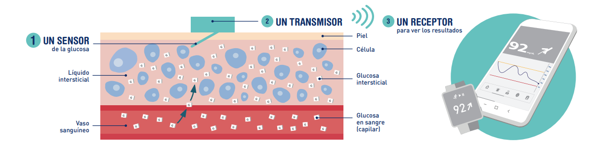 Componentes Monitorización Continua de glucosa