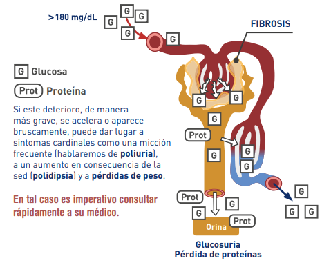 Fibrosis