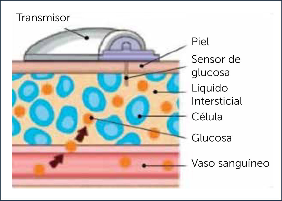 Glucómetro No Invasivo, Medidor De Glucosa Sin Pinchar