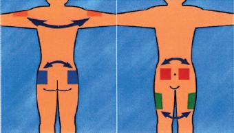 Técnicas de inyección de insulina