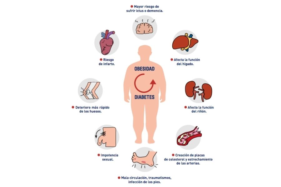 Obesidad y diabetes tipo 2: Relación, riesgos y tratamiento - iMagazine ...