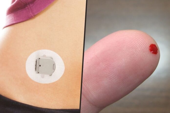 sensor-gota MCG vs glucosa capilar